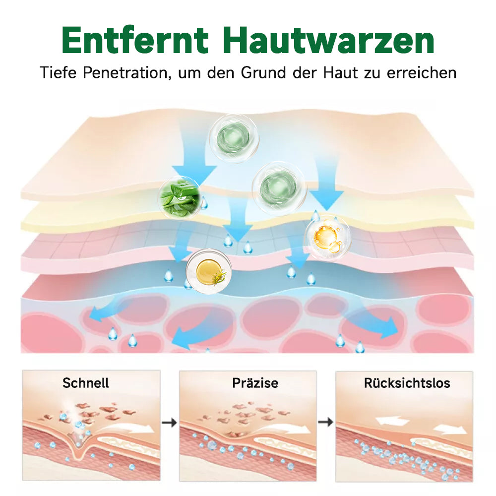 Furzero™ 20% Salicylsäure Hautbehandlungscreme ✔️ Dermatologisch geprüft ✔️ Sichere und schnell wirkende Formel ✔️ Hilft bei Warzen, Psoriasis, Ekzemen und mehr