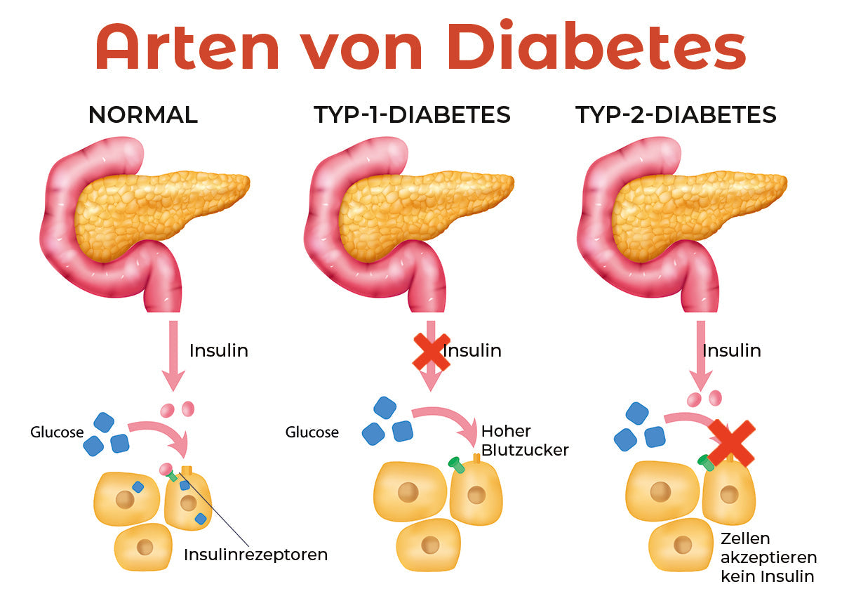 đ„Futuslyâą Blutzuckerregulation - medizinisches Gesundheitsarmband
