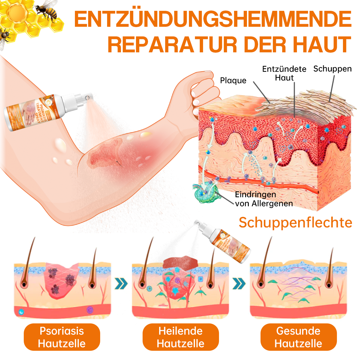 🔥Furzero™ Neuseeland Bienengift Psoriasis Behandlungsspray (Für alle Hautzustände geeignet)