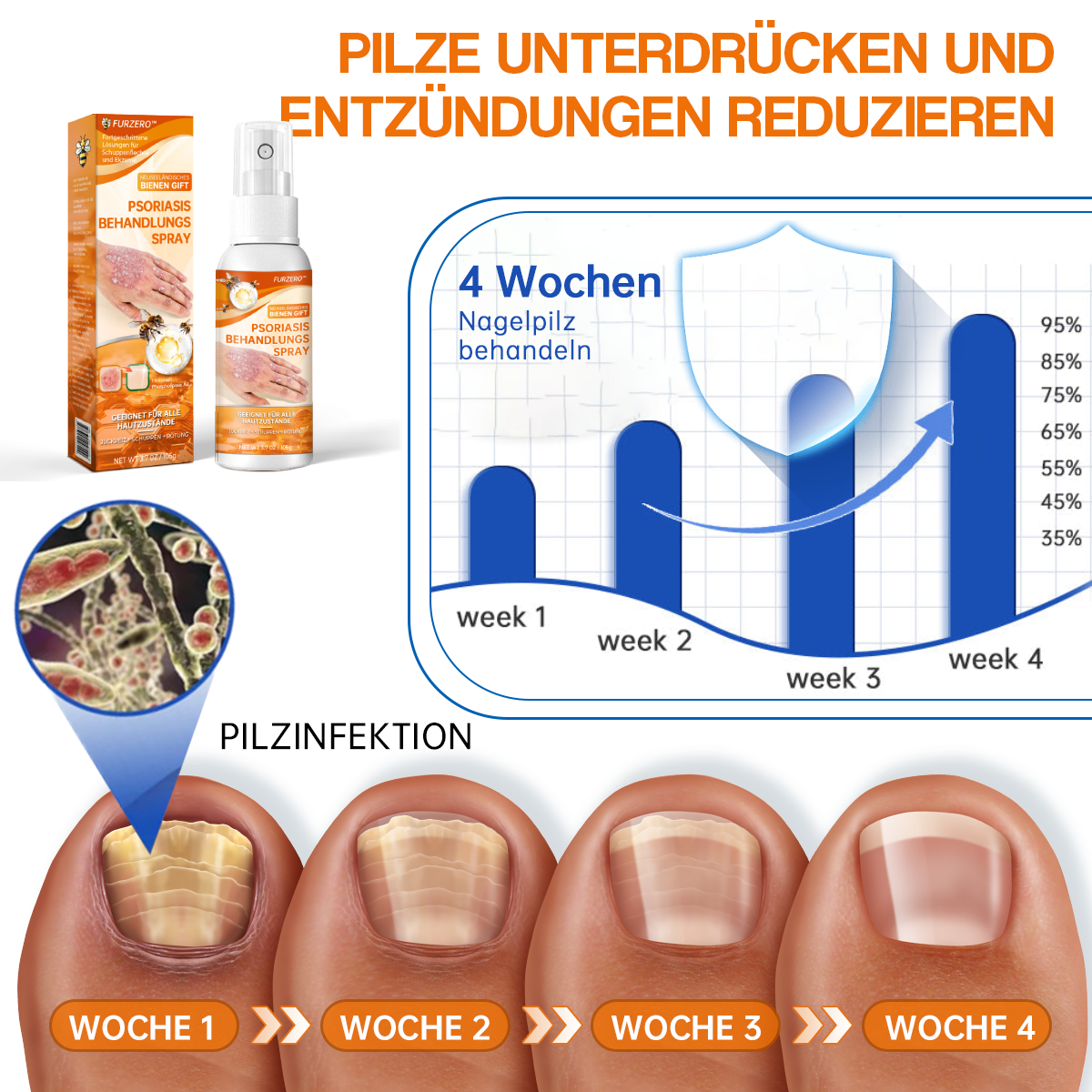 🔥Furzero™ Neuseeland Bienengift Psoriasis Behandlungsspray (Für alle Hautzustände geeignet)