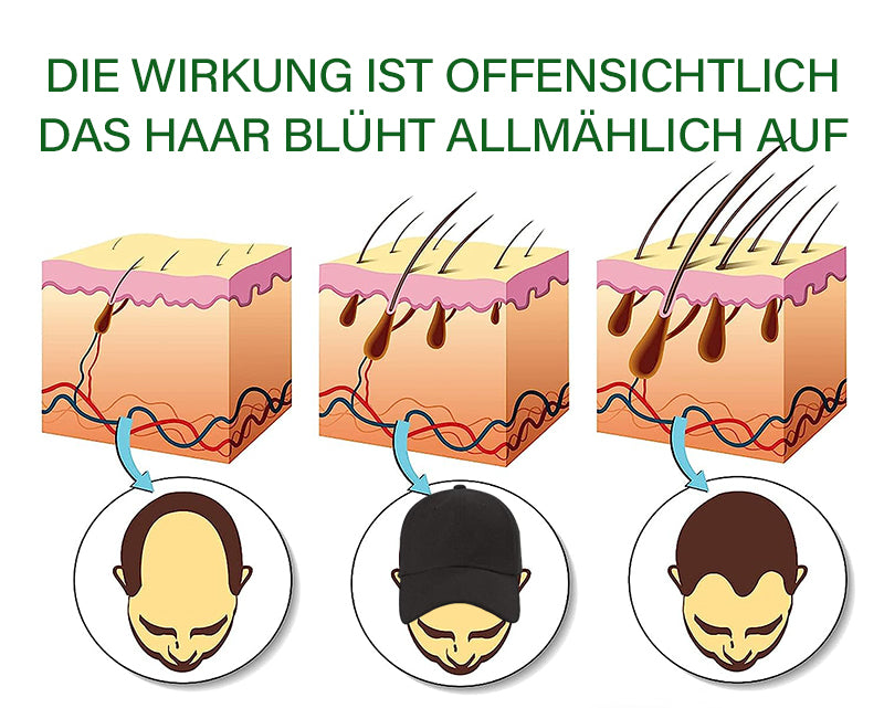 Sugoola™ LLLT Niedrige Energie Rot Blau Licht Bestrahlung Haar Haarwuchs und Öl Kontrolle Kopfhaut Pflege Kappe (FDA-zugelassen)