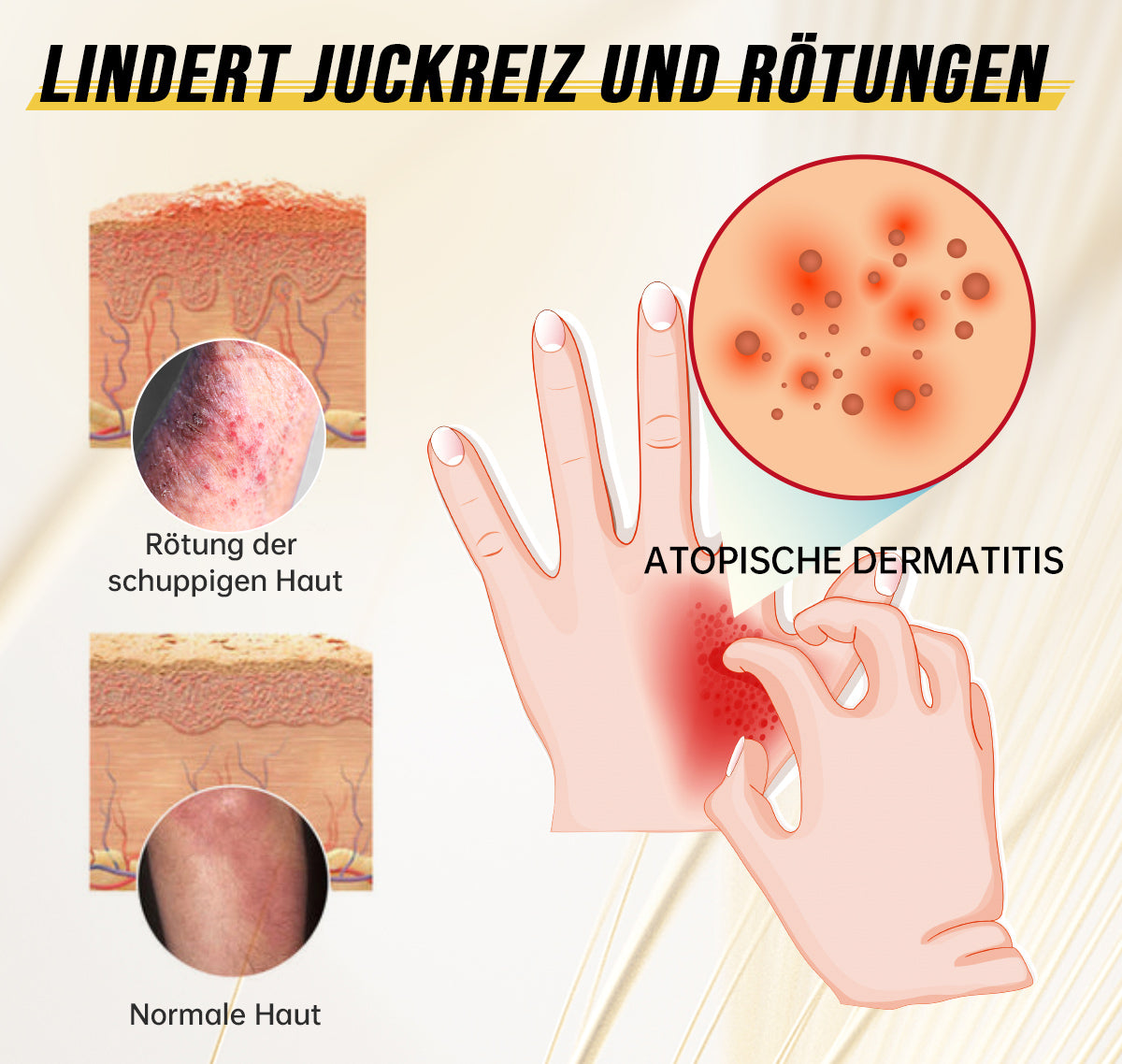 Ourlyard™ Psoriasis-Handgerät-UVB-Phototherapielampe (geeignet für alle Hauttypen)