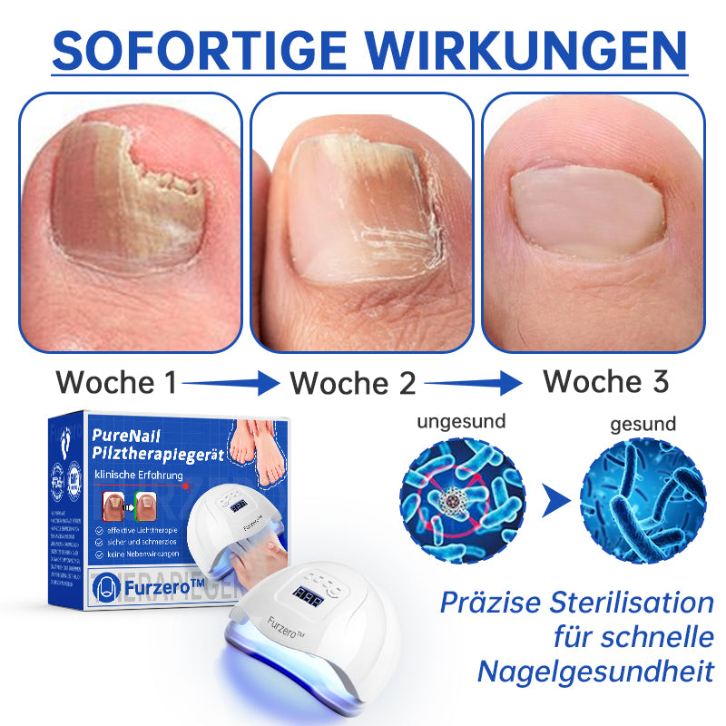 đ„Furzeroâą PureNail Pilz-LasertherapiegerĂ€t