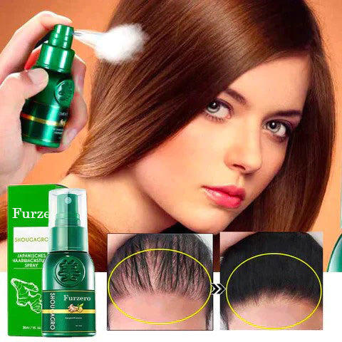 Furzero⢠ShougaGRO Japanisches Haarwachstumsspray (đĽZeitlich begrenzter Rabatt, âłletzte 30 Minuten)
