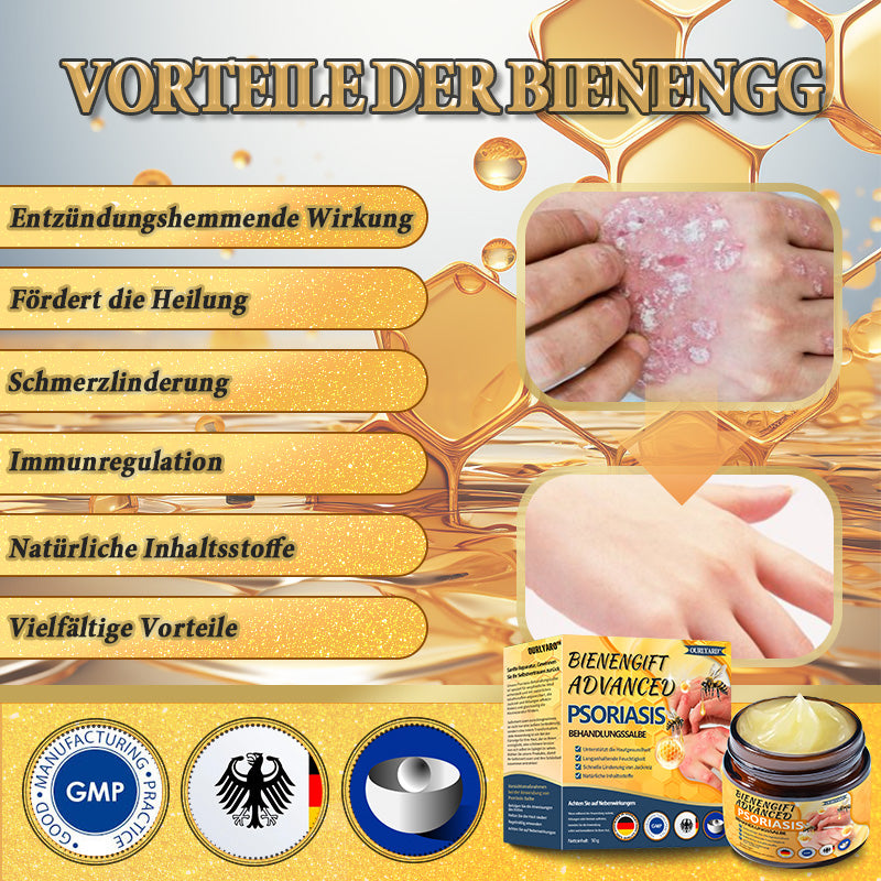 🌿🌿Ourlyard™ Bienengift Advanced Psoriasis Behandlungssalbe (👨Vom Arzt empfohlen)