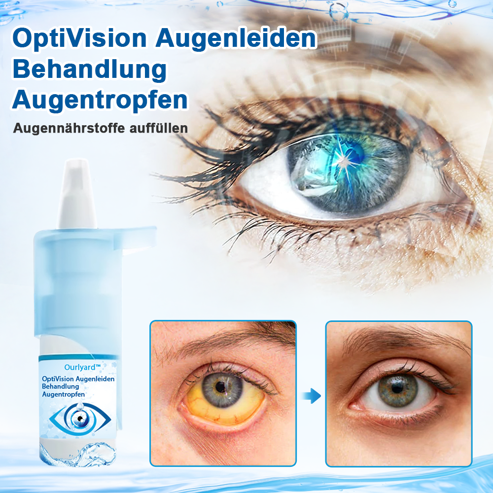 Ourlyard™ OptiVision Augenprobleme Behandlung Augentropfen