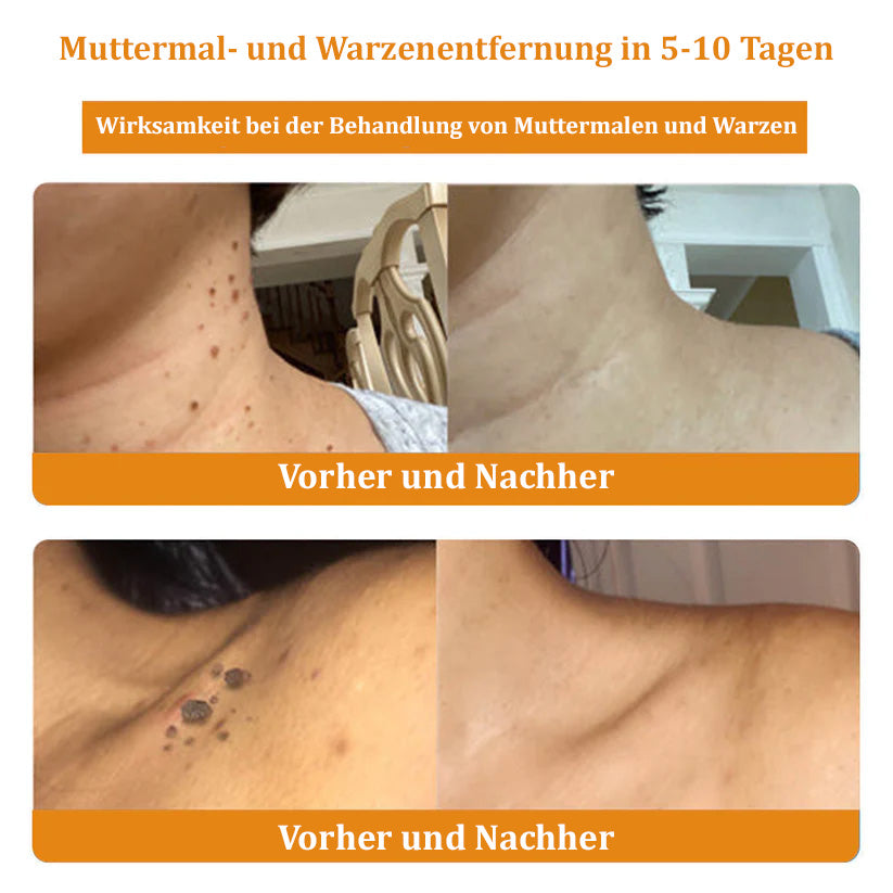 đżđżTuronuâą Bienengift Multitherapie-Creme(đ§ââïžâ
Dermatest-Zertifizierung)