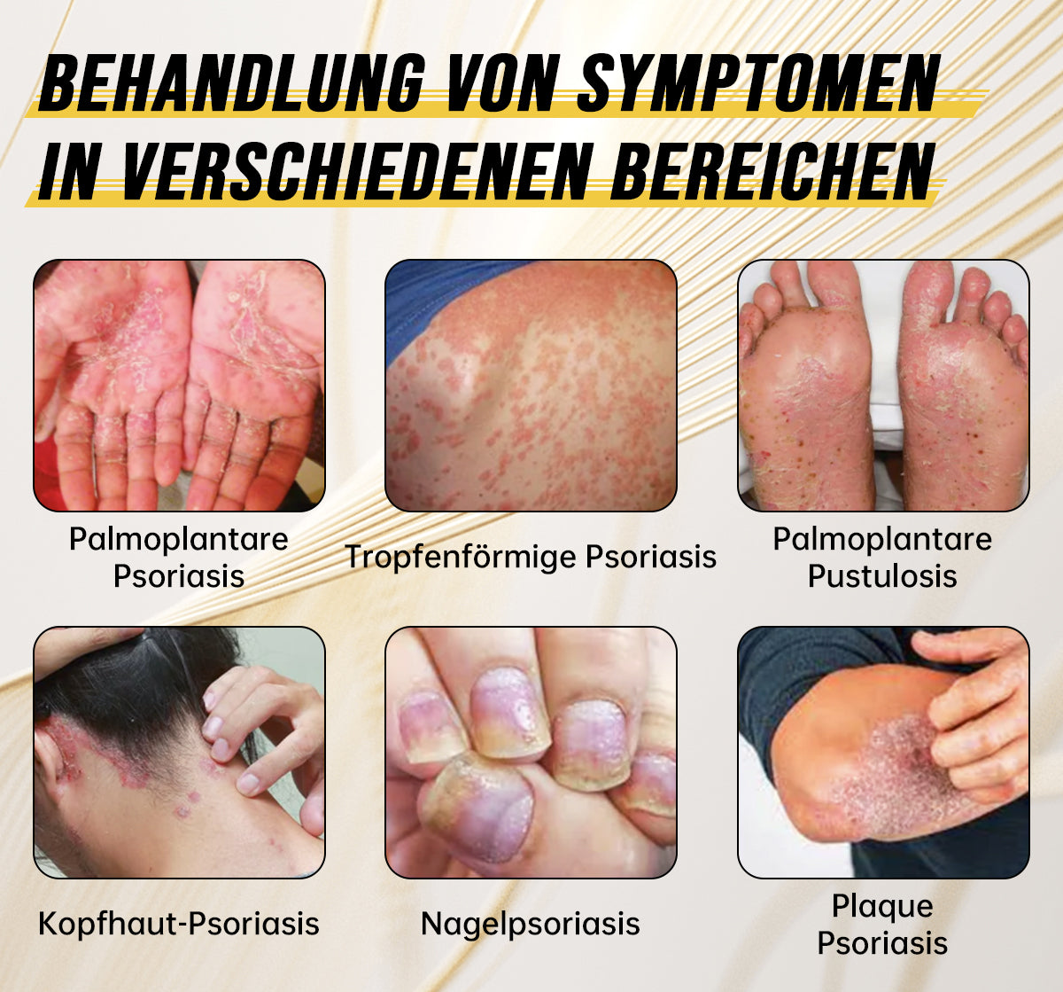 Ourlyard™ Psoriasis-Handgerät-UVB-Phototherapielampe (geeignet für alle Hauttypen)