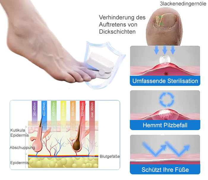 đ„đ„Ourlyardâą LeistungsfĂ€higes LichttherapiegerĂ€t zur Behandlung von Nagelerkrankungen
