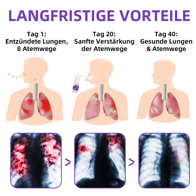 Furzero™️ Lungen-Spray mit Lilienwurzel-Kräuterextrakten
