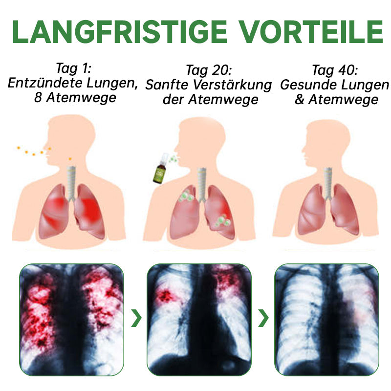 🔥Furzero™️ Atementgiftendes Kräuterlungenreinigungsspray