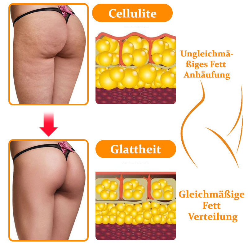 Sugoola™ EMS-Gesäßstraffungsmassagegerät