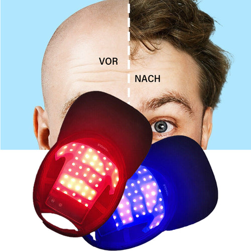Sugoola™ LLLT Niedrige Energie Rot Blau Licht Bestrahlung Haar Haarwuchs und Öl Kontrolle Kopfhaut Pflege Kappe (FDA-zugelassen)