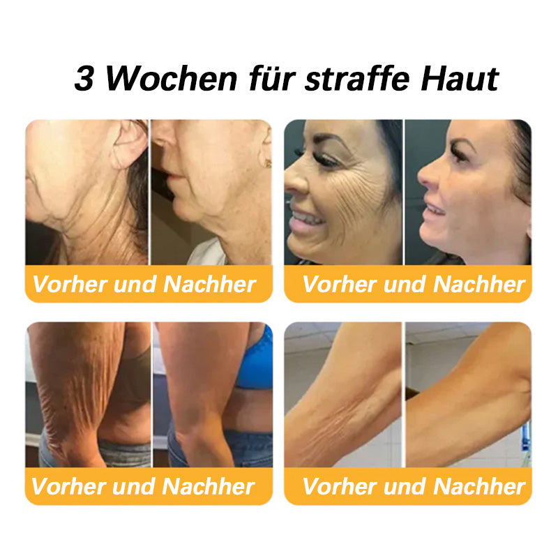 Furzero™ Premium Straffende Kollagen Peptid Creme: Effektive Lösung gegen Falten & Hauterschlaffung (Bekämpft Falten & Hauterschlaffung) 🔥 LETZTER TAG SALE 70% RABATT
