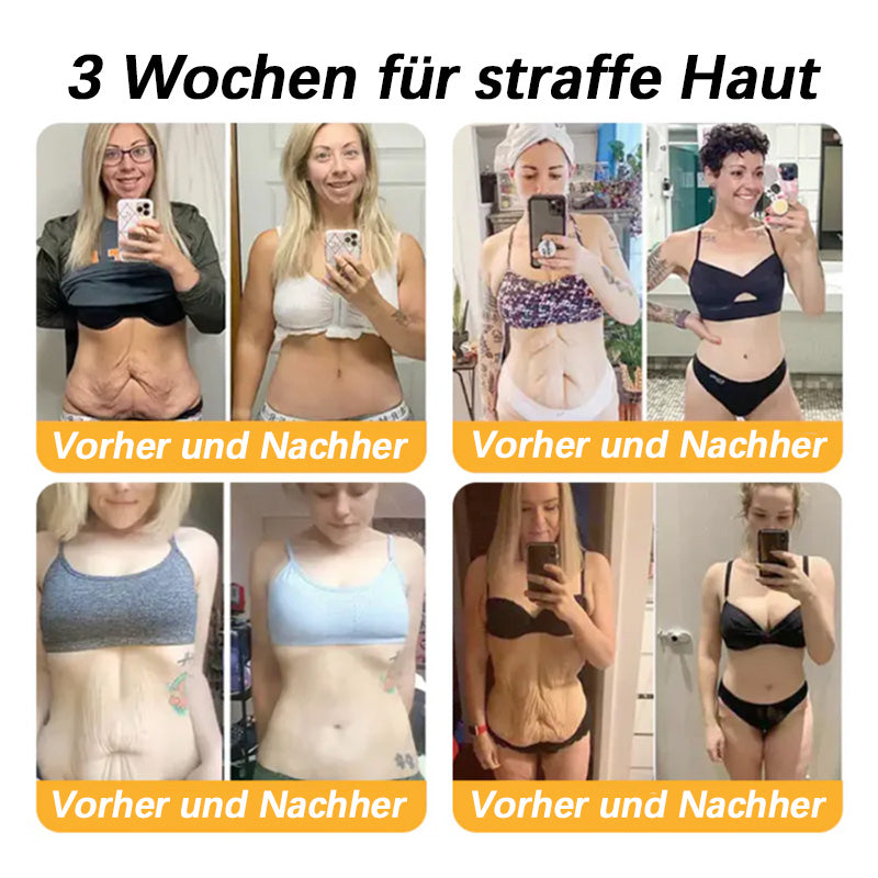 Furzero™ Premium Straffende Kollagen Peptid Creme: Effektive Lösung gegen Falten & Hauterschlaffung (Bekämpft Falten & Hauterschlaffung) 🔥 LETZTER TAG SALE 70% RABATT