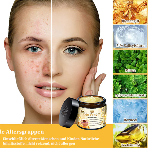 đżđżTuronuâą Bienengift Multitherapie-Creme(đ§ââïžâ
Dermatest-Zertifizierung)