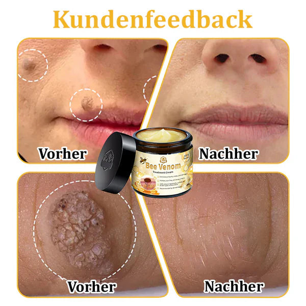 đżđżTuronuâą Bienengift Multitherapie-Creme(đ§ââïžâ
Dermatest-Zertifizierung)
