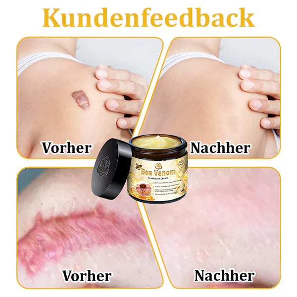 đżđżTuronuâą Bienengift Multitherapie-Creme(đ§ââïžâ
Dermatest-Zertifizierung)