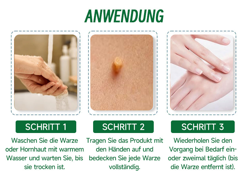 🌱🌱Furzero™ 20% Salicylsäure Hautbehandlungscreme ✔️ Dermatologisch geprüft ✔️ Sichere und schnell wirkende Formel ✔️ Hilft bei Warzen, Psoriasis, Ekzemen und mehr