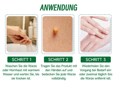 🌱🌱Furzero™ 20% Salicylsäure Hautbehandlungscreme ✔️ Dermatologisch geprüft ✔️ Sichere und schnell wirkende Formel ✔️ Hilft bei Warzen, Psoriasis, Ekzemen und mehr