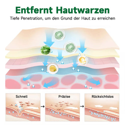 🌱🌱Furzero™ 20% Salicylsäure Hautbehandlungscreme ✔️ Dermatologisch geprüft ✔️ Sichere und schnell wirkende Formel ✔️ Hilft bei Warzen, Psoriasis, Ekzemen und mehr