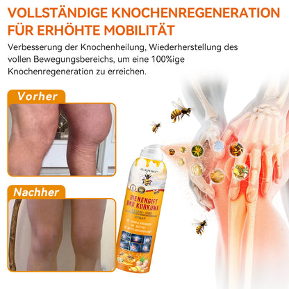 Furzero™ Bienengift- und Kurkuma-Gelenk- und Knochenschmerzlinderungs-Spray (Spezialisiert auf Gelenk- und Arthritisbeschwerden & empfohlen von der AAOS)