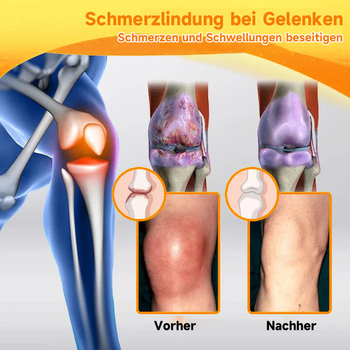 🌿🌿Furzero™ Bienengift- und Kurkuma-Gelenk- und Knochenschmerzlinderungscreme (Spezialisiert auf Gelenk- und Arthritisbeschwerden & empfohlen von der AAOS)