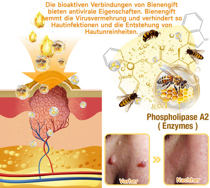 Furzero™ Bienengift-Hautpflegeserum (👩‍⚕️✅ Dermatologisch getestet)