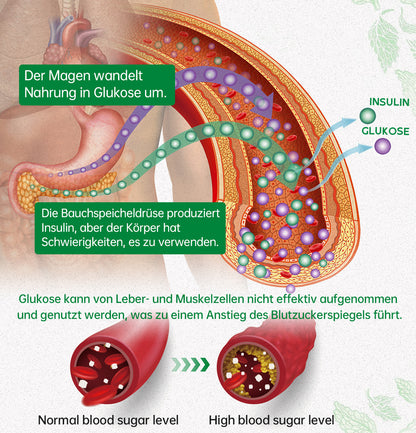 Furzero™ DiabetesCare SugarDown Gesundheitskontroll-Spray