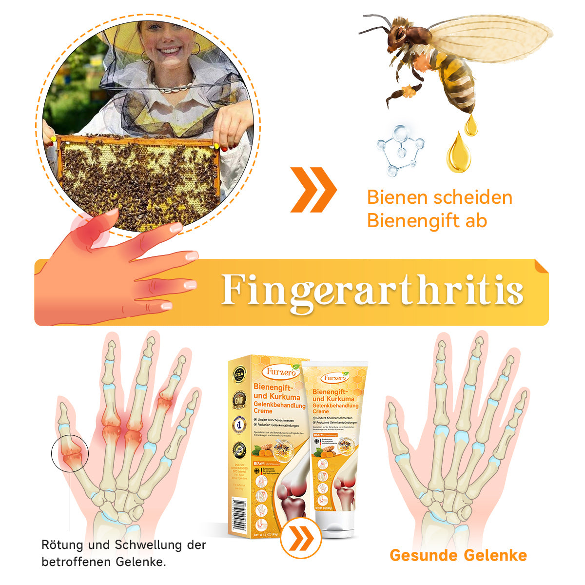 🌿Furzero™ Bienengift- und Kurkuma-Gelenkbehandlung-Creme (Spezialisiert auf die Linderung von orthopädischen Beschwerden und Arthritisschmerzen)