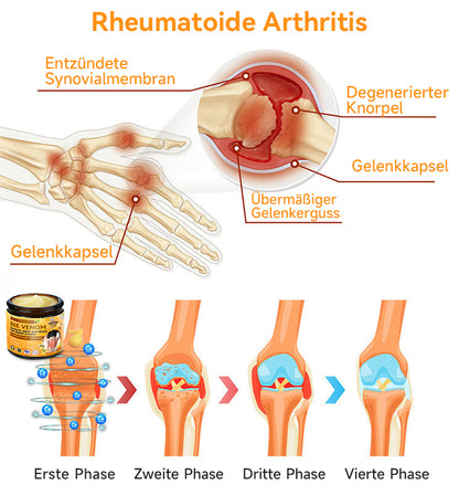 👩‍⚕️✅Furzero™ Bienengift- und Kurkuma-Gelenk- und Knochenschmerzlinderungscreme (Spezialisiert auf Gelenk- und Arthritisbeschwerden & empfohlen von der AAOS)