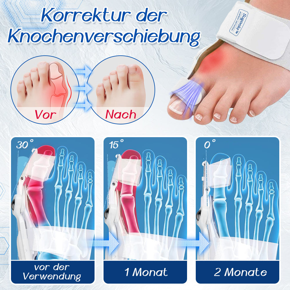 Sugoola™ Bunion Correction Kit:Lösen Sie leicht Ihre-Daumenschmerzen [ Keine Operation erforderlich ]