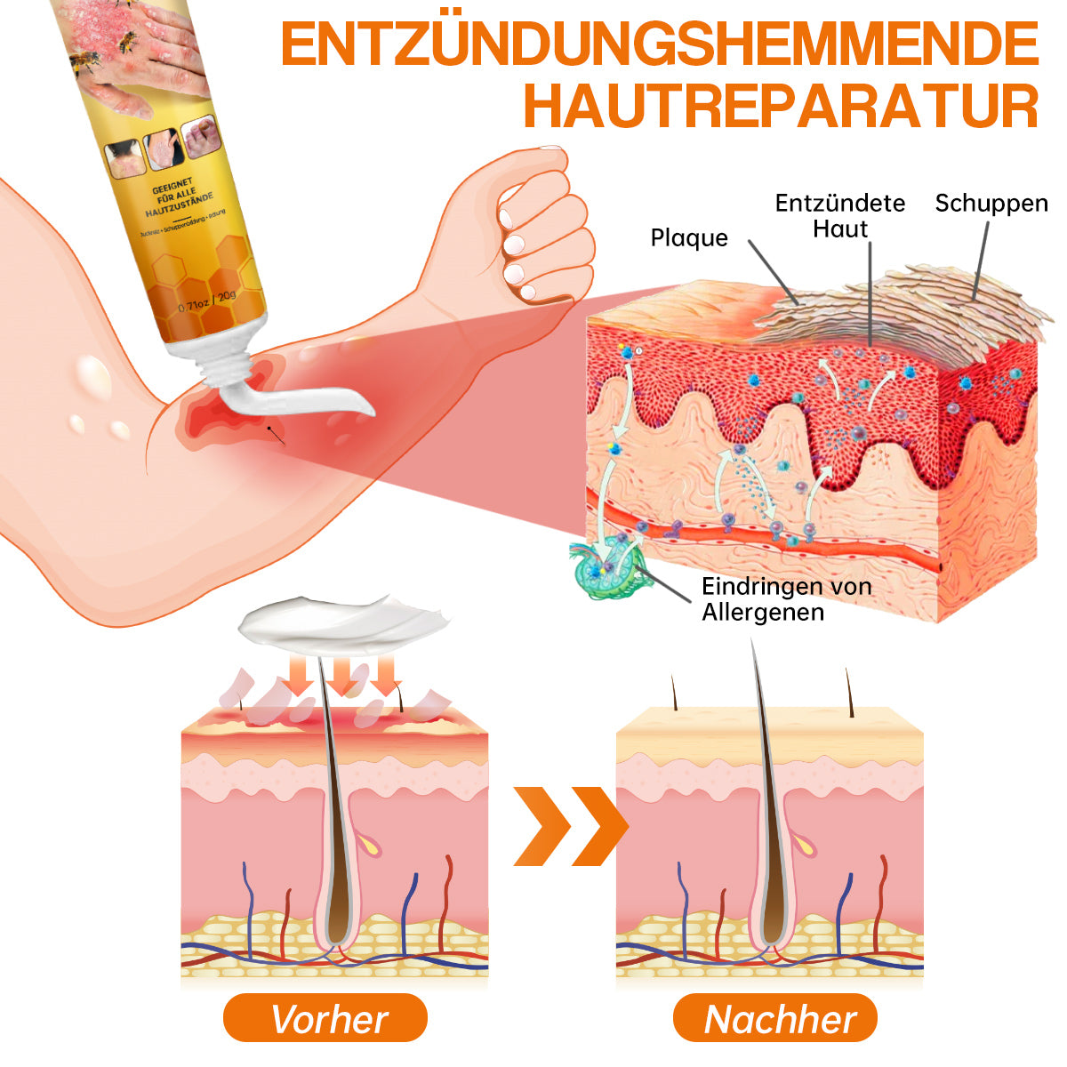 🐝🐝Furzero™ Neuseeland Bienengift Psoriasis-Behandlungscreme (Geeignet für alle Hautbedingungen)