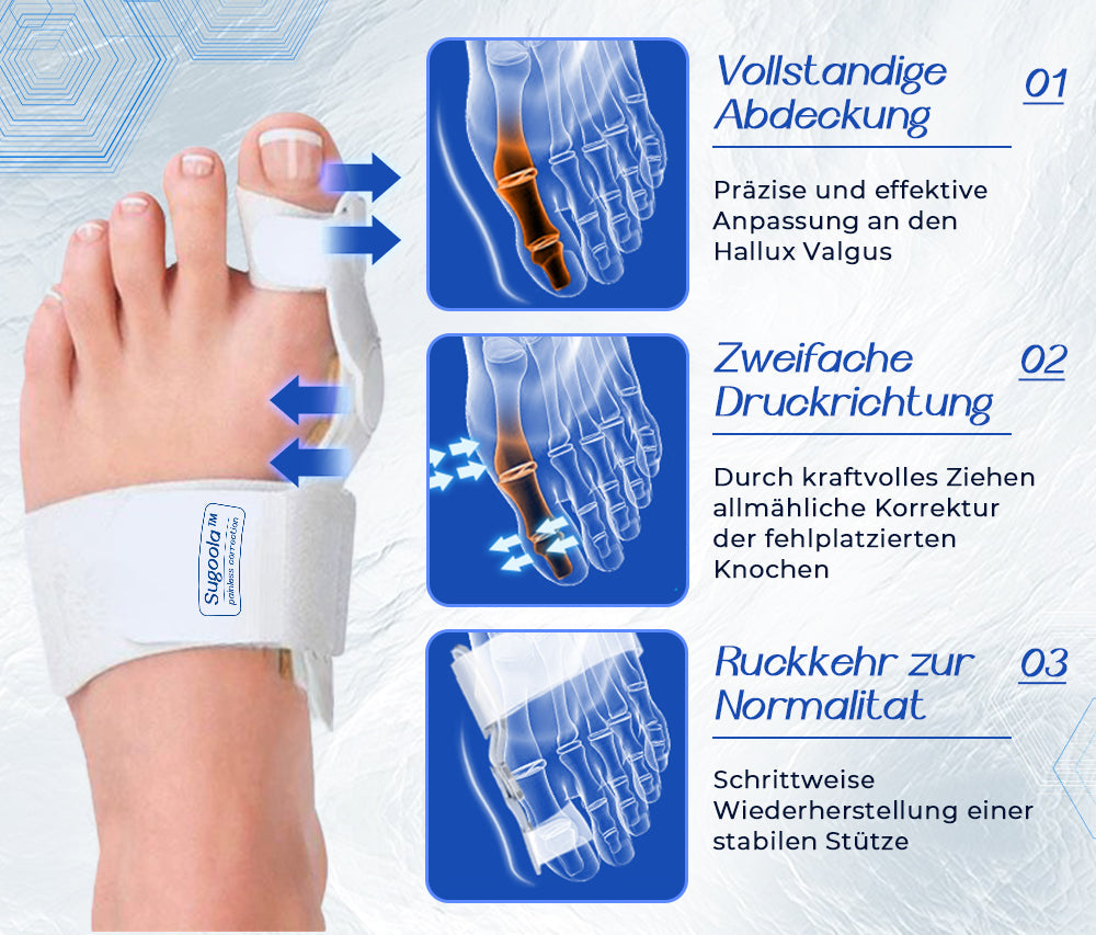 Sugoola™ Bunion Correction Kit:Lösen Sie leicht Ihre-Daumenschmerzen [ Keine Operation erforderlich ]