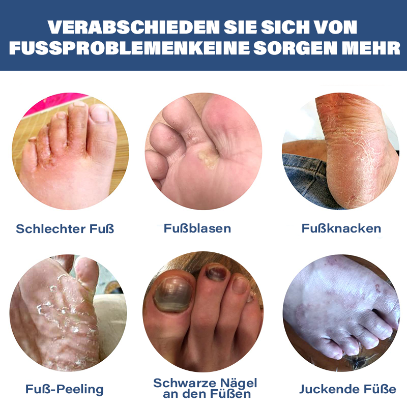 Furzero™ Nagelpilz-Fußspray