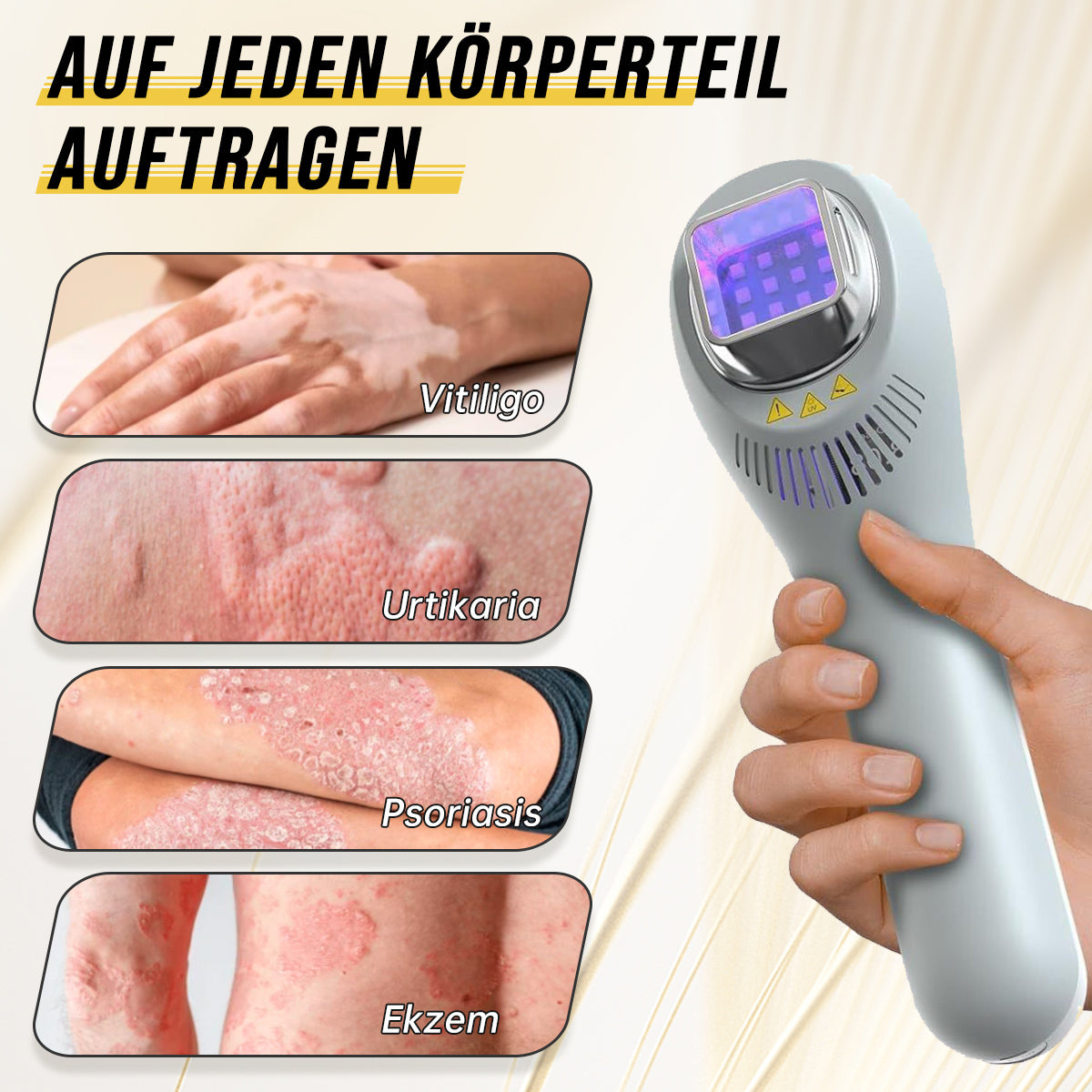 🔥🔥Ourlyard™ Psoriasis-Handgerät-UVB-Phototherapielampe (geeignet für alle Hauttypen)