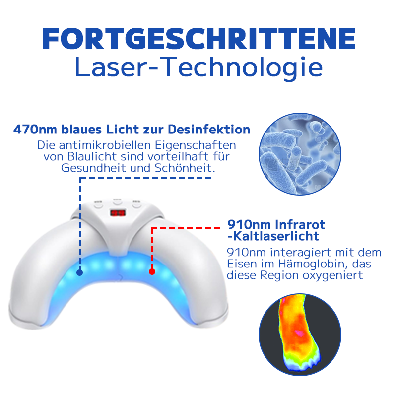 Furzero™ Pilzbehandlungs-Lasergerät für Nägel