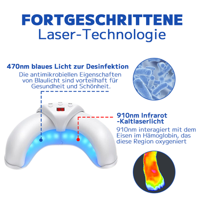 Furzero™ Pilzbehandlungs-Lasergerät für Nägel