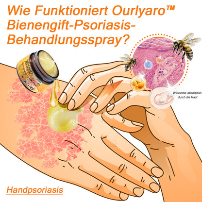 🌿🌿Ourlyard™ Bienengift Advanced Psoriasis Behandlungssalbe (👨Vom Arzt empfohlen)