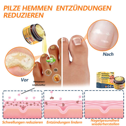 🌿Ourlyard™ Bienengift Advanced Psoriasis Behandlungssalbe (👨Vom Arzt empfohlen)