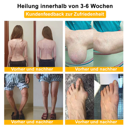 ✅ Offizieller Shop: flysmus™ Lidocaine Narbenfreie Schmerzstillende Heilflüssigkeit 👨‍⚕️ Orthopädische Vereinigung (DGOU) Zugelassen (Reduzierung von Gelenkschwellungen, Schmerzen, Steifheit, Rötung, Wärme, Empfindlichkeit und Gelenkmüdigkeit)