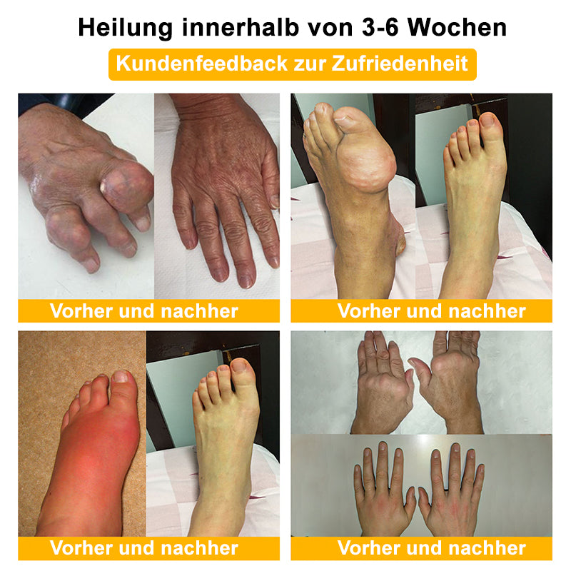 ✅ Offizieller Shop: flysmus™ Lidocaine Narbenfreie Schmerzstillende Heilflüssigkeit 👨‍⚕️ Orthopädische Vereinigung (DGOU) Zugelassen (Reduzierung von Gelenkschwellungen, Schmerzen, Steifheit, Rötung, Wärme, Empfindlichkeit und Gelenkmüdigkeit)