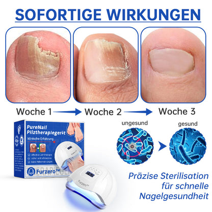 🔥🔥Furzero™ PureNail Pilz-Lasertherapiegerät