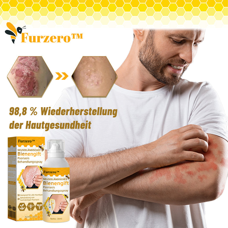 🧑‍⚕️Furzero™ Neuseeländisches Bienengift Psoriasis Behandlungsspray (Geeignet für alle Hauttypen)