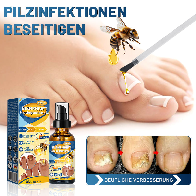 Furzero™ Bienengift-Nagelreparaturserum (👩‍⚕️✅ Dermatologisch getestet)🐝🐝