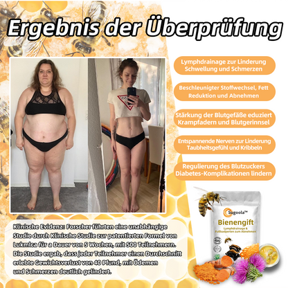 🔥🔥Sugoola™ 🐝Beim Venom Lymphtische Entwässerung & Schlankheits Fußbad Perlen🫚 - BMG Erwartete Empfehlungen👍