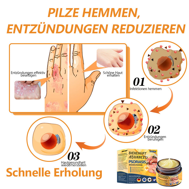 🌿Ourlyard™ Bienengift Advanced Psoriasis Behandlungssalbe (👨Vom Arzt empfohlen)