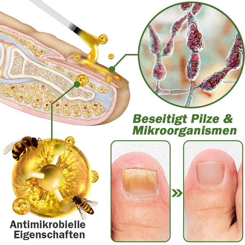 👍Furzero™ Nagelverteidigung Bienengift-Behandlungsserum pro