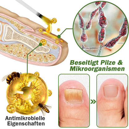 👍Furzero™ Nagelverteidigung Bienengift-Behandlungsserum pro