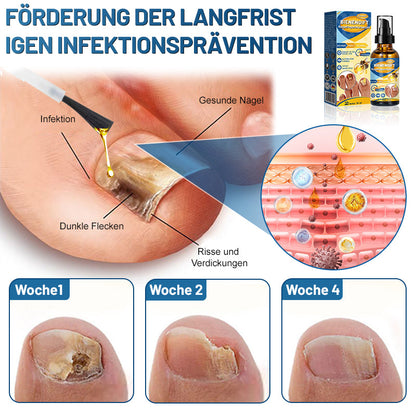 Furzero™ Bienengift-Nagelreparaturserum (👩‍⚕️✅ Dermatologisch getestet)🐝🐝